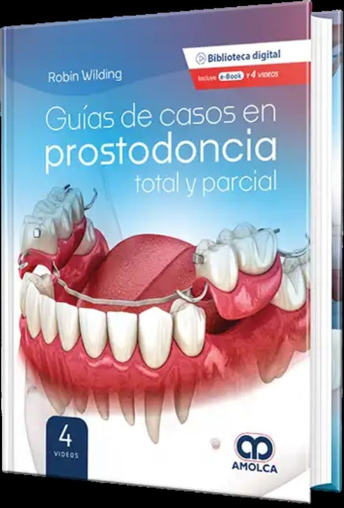 GUÍAS DE CASOS EN PROSTODONCIA TOTAL Y PARCIAL